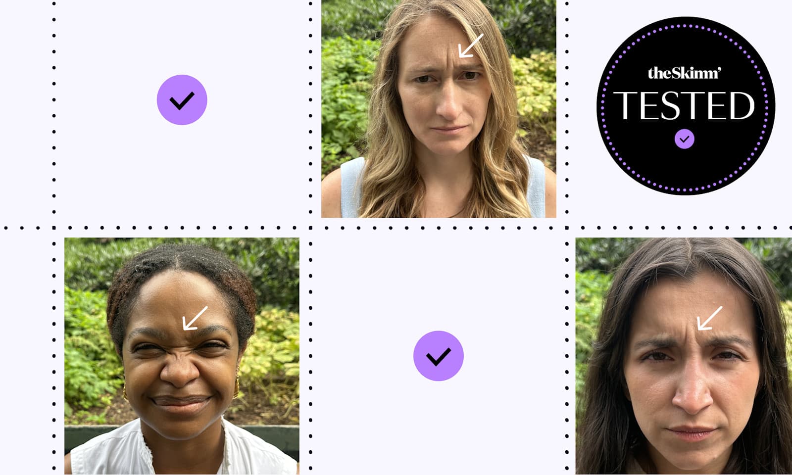 images of testers before dysport