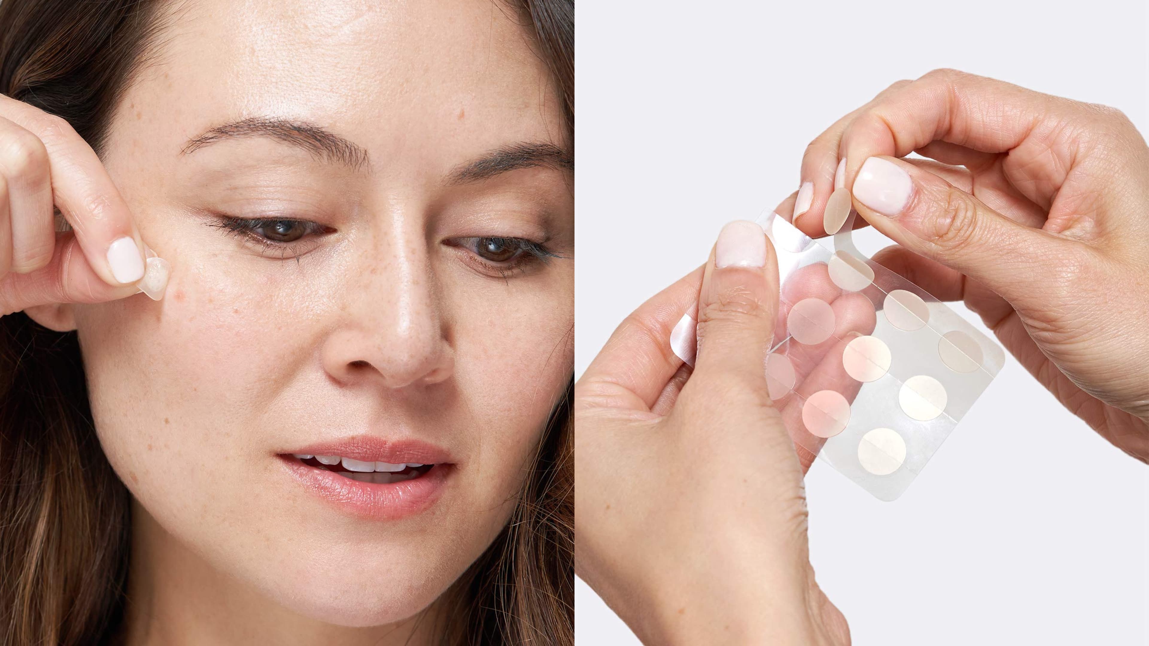 Pimple patches