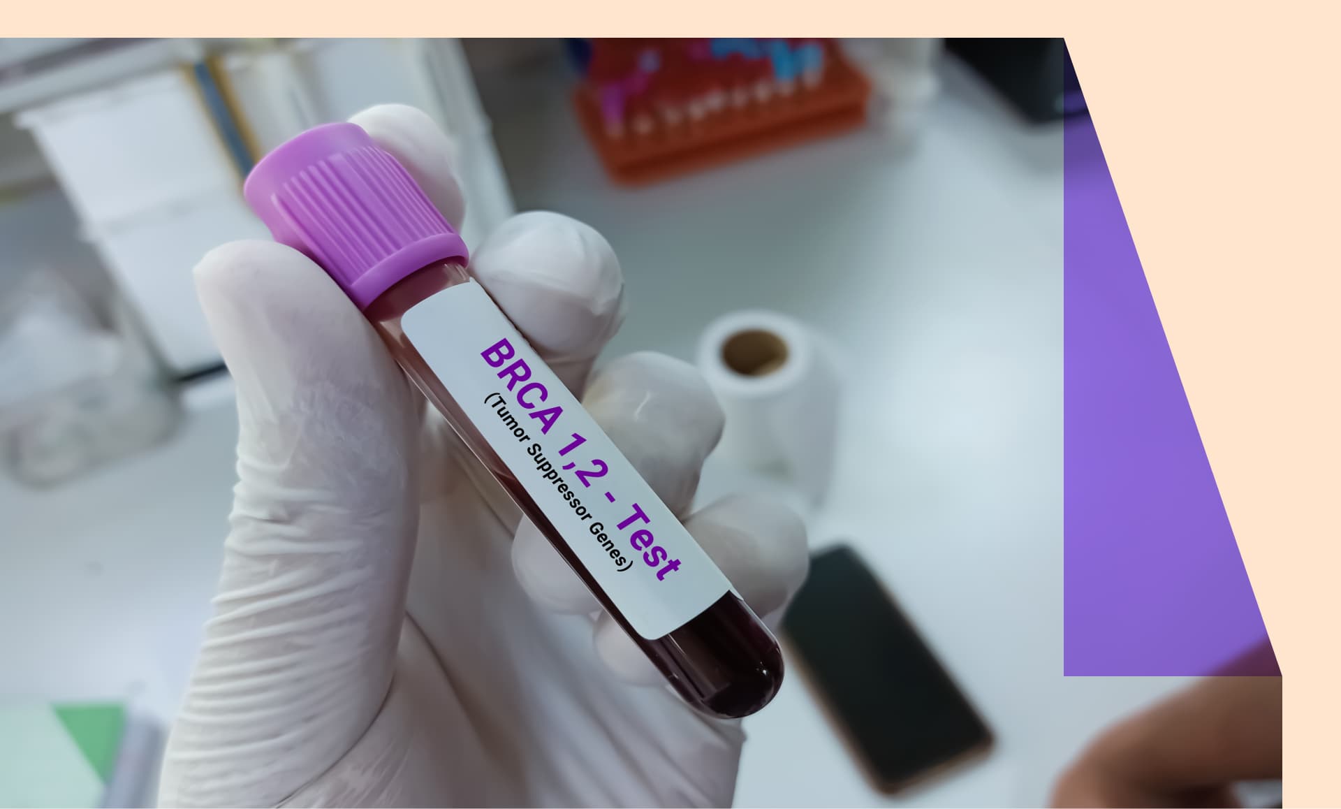 BRCA test tube