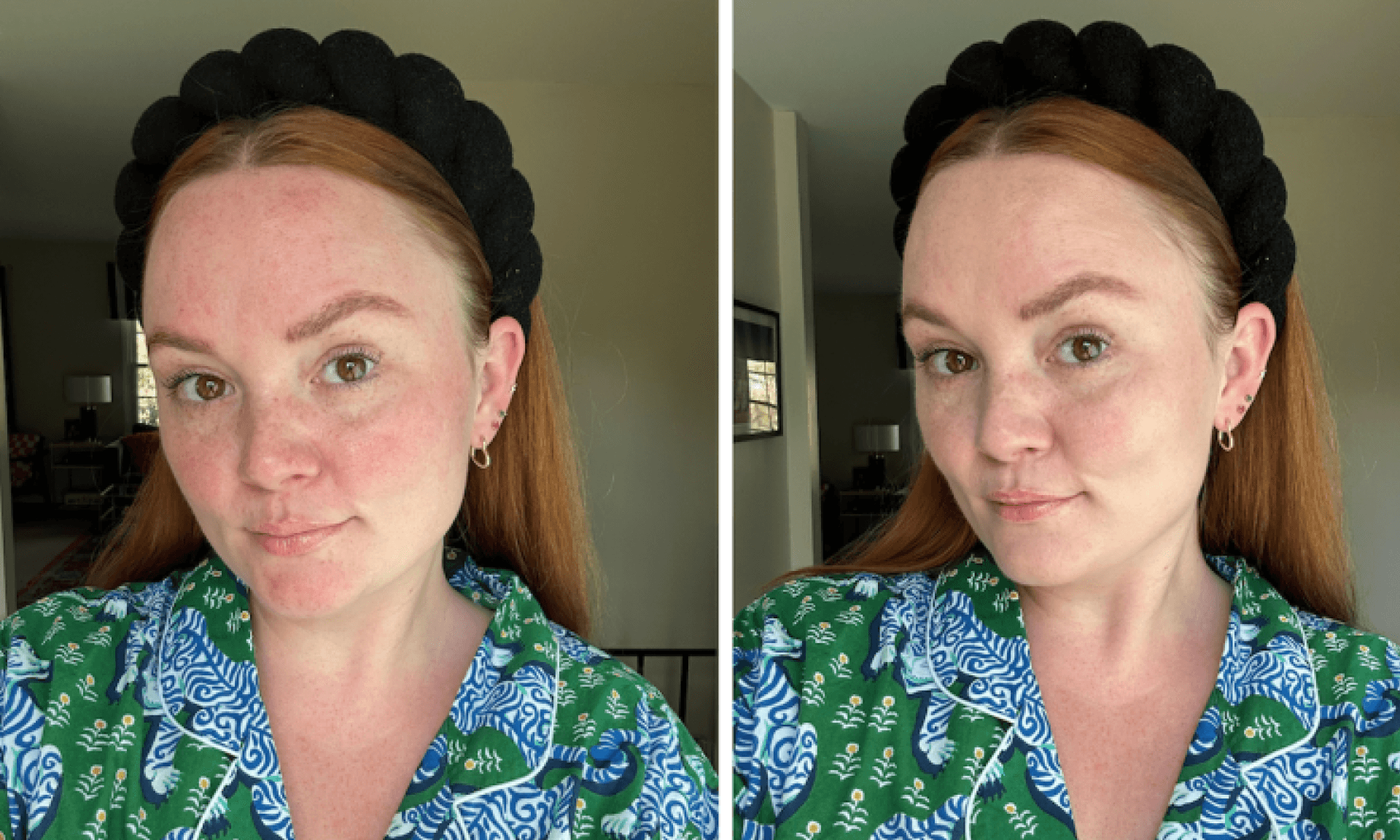 before and after photo