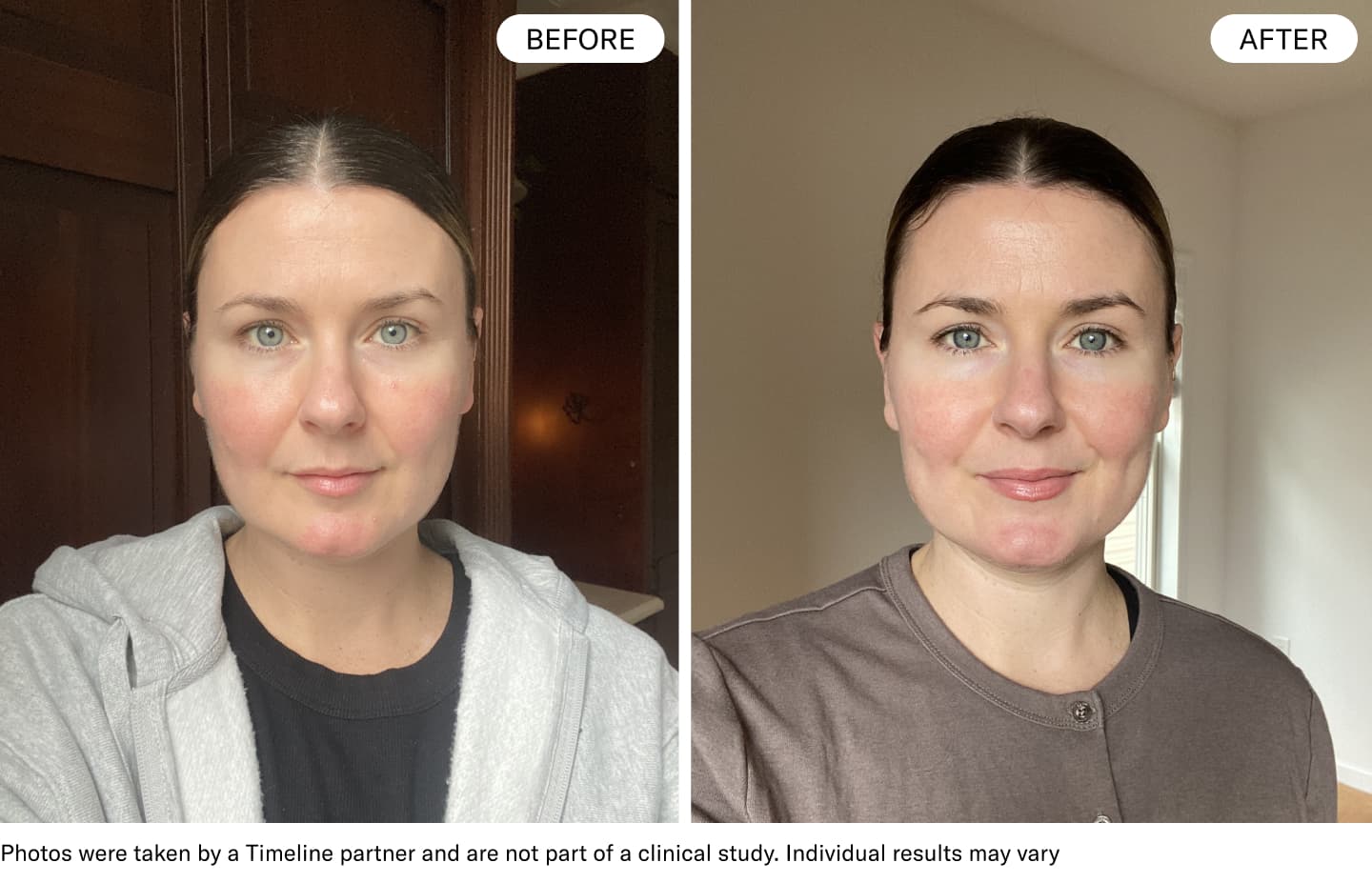 timeline before and after