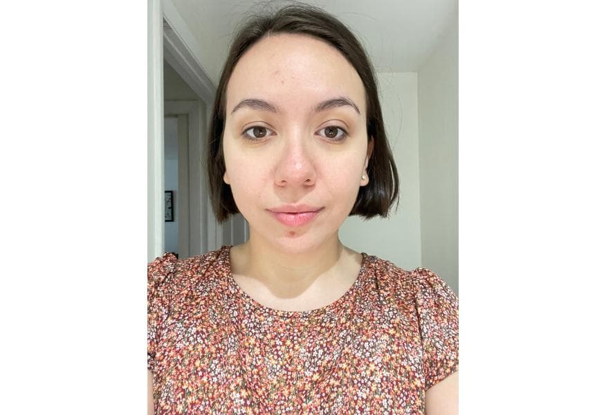 alexa showing her skin before using the wrinklit led mask