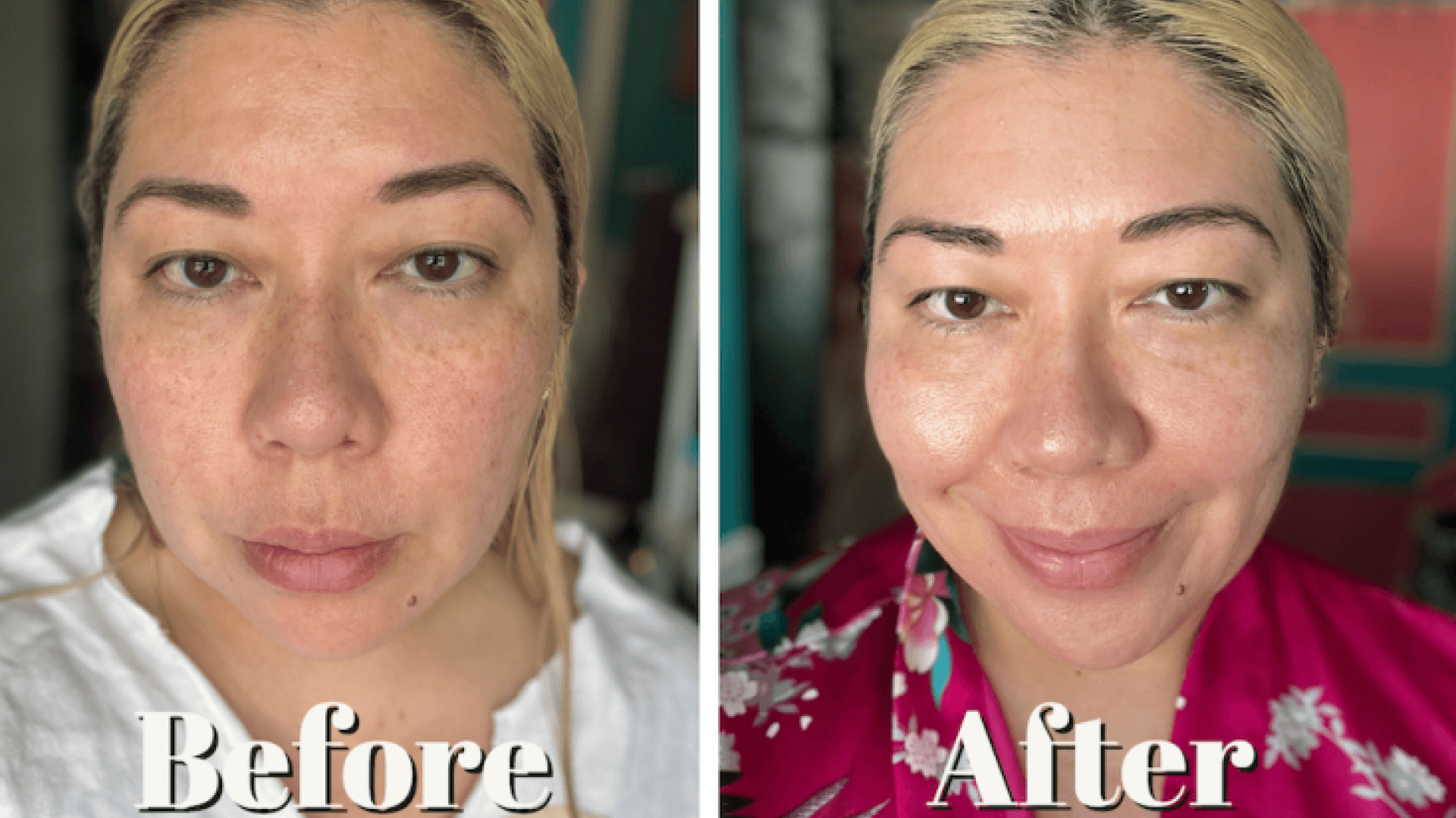 Alastin A-Luminate Brightening Serum Review